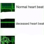 Normal heartbeat (blank)  meme template blank