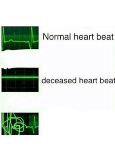 Normal heartbeat (blank) Drake meme template