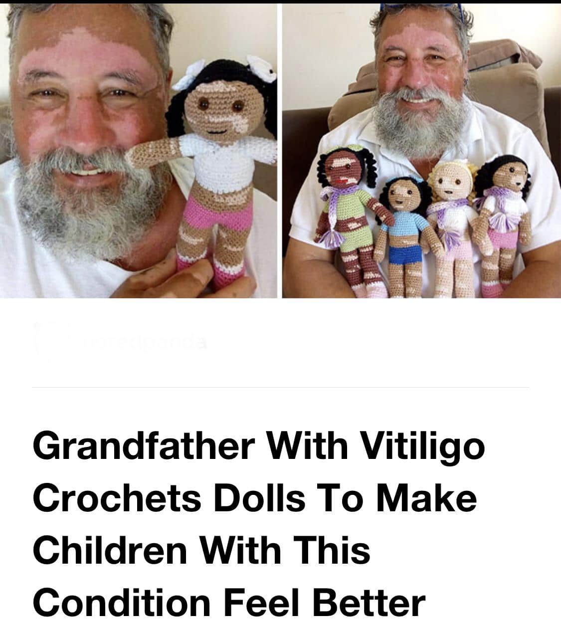 cute wholesome-memes cute text: Grandfather With Vitiligo Crochets Dolls To Make Children With This Condition Feel Better 