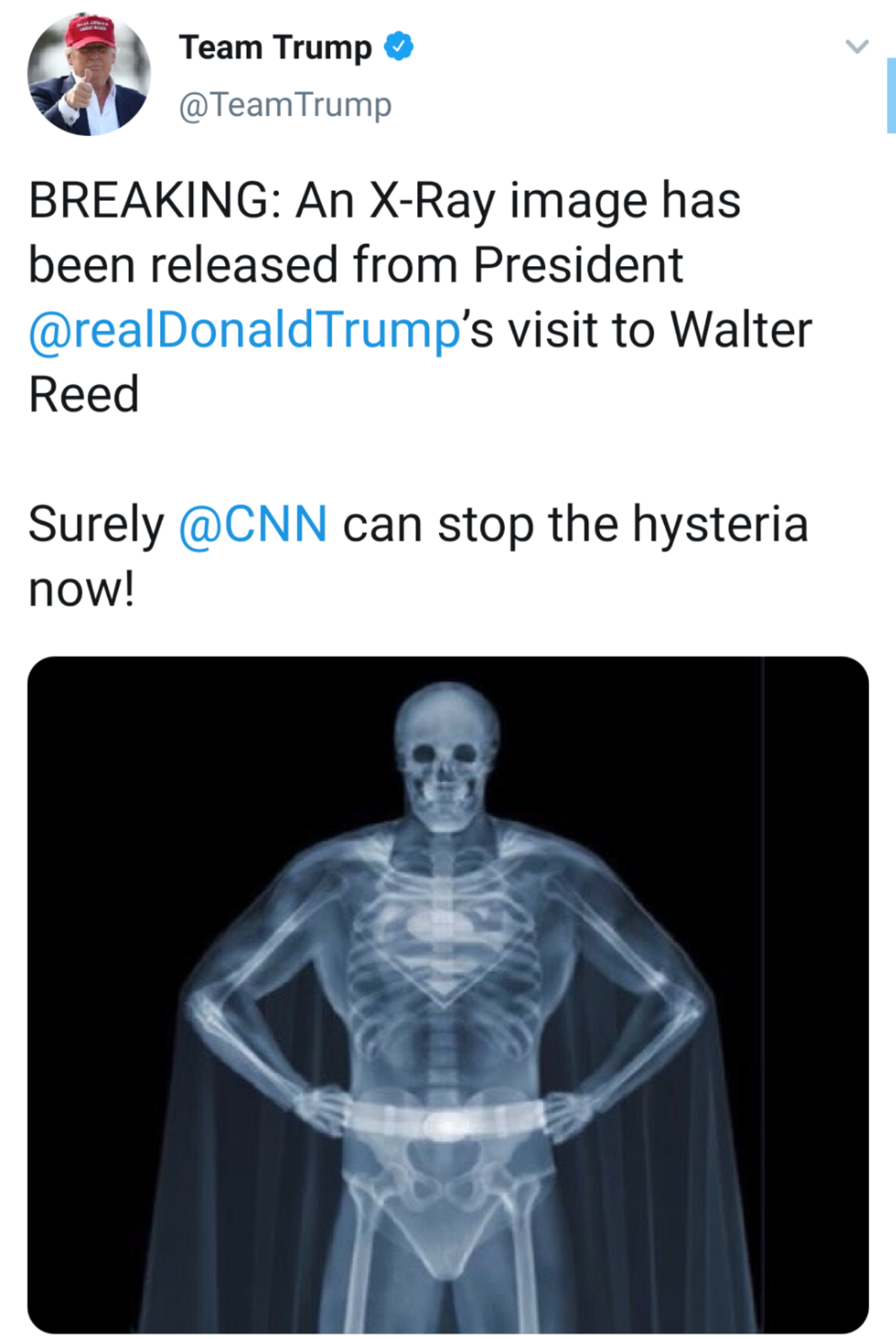 political boomer-memes political text: Team Trump @TeamTrump BREAKING: An x-Ray image has been released from President @realDonaIdTrump's visit to Walter Reed Surely can stop the hysteria @CNN now! 