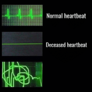 Normal Heartbeat, Deceased Heartbeat  Reaction meme template