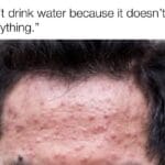 Water Memes Water, YMMV, Yoshikage Kira, Accutane, Zinc, SkincareAddiction text: "l don
