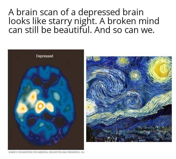 Wholesome memes, Starry Night Wholesome Memes Wholesome memes, Starry Night text: A brain scan of a depressed brain looks like starry night. A broken mind can still be beautiful. And so can we. souNOATlON MEDICAL EOL'CATION ANO RESEARCSL ALI 