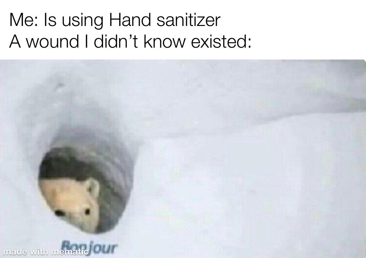 Dank, OC Dank Memes Dank, OC text: Me: Is using Hand sanitizer A wound I didn't know existed: mpjour 